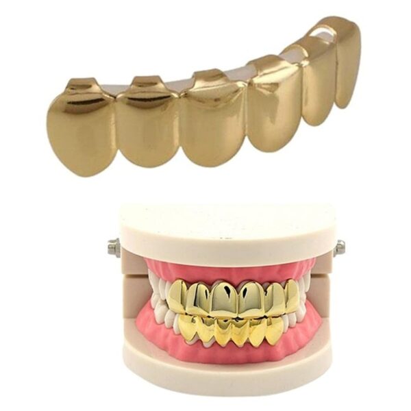 Những trường hợp nào phù hợp nên làm răng mạ vàng?