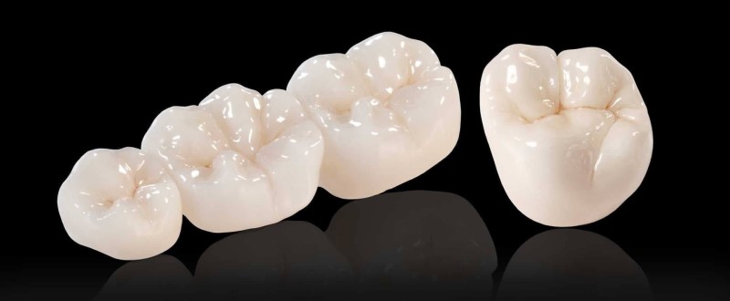 Răng sứ zirconia dạng rắn Full solid có độ chắc chắn cao, chịu lực tốt với sườn toàn zirconia bên trong. Thích hợp trong thẩm mỹ cho răng hàm.