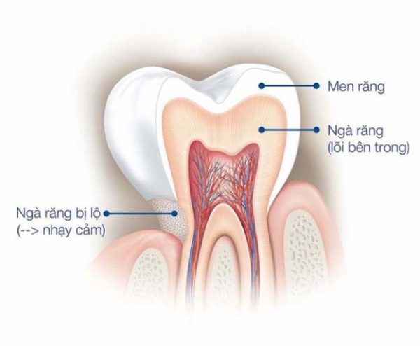Men răng là một lớp trắng dày đặc ngoài cùng bao bọc quanh thân răng giúp bảo vệ răng khỏi những tác nhân làm hư hại.