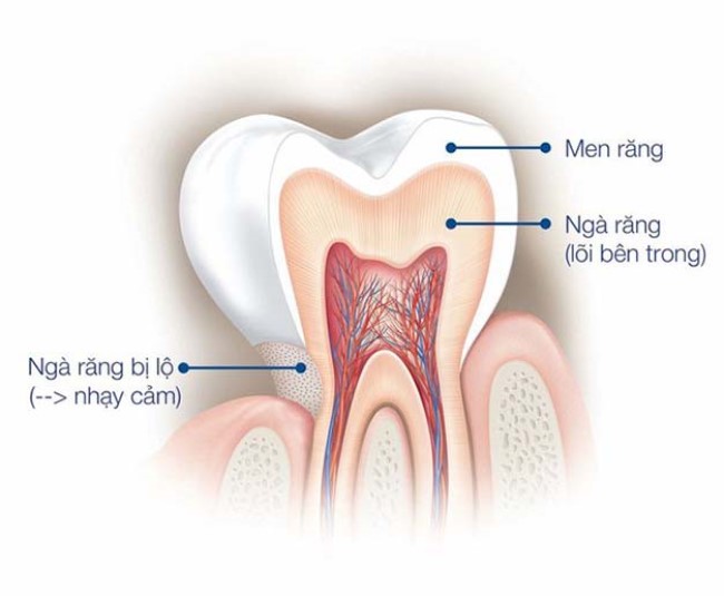 Men răng là một lớp trắng dày đặc ngoài cùng bao bọc quanh thân răng giúp bảo vệ răng khỏi những tác nhân làm hư hại.
