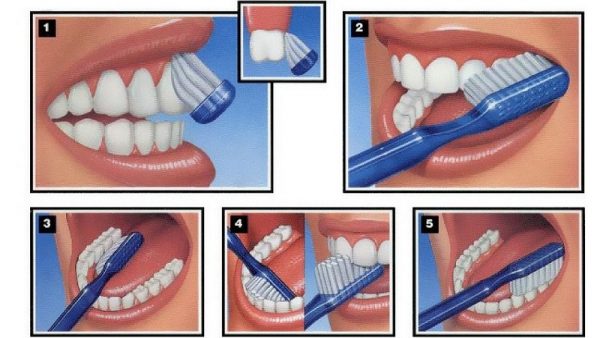 Chải răng đúng cách giúp làm sạch răng miệng một cách toàn diện nhất