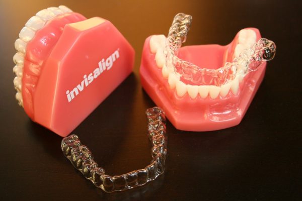 Niềng răng trong suốt Invisalign được hiểu là một hình thức chỉnh nha sử dụng khay nhựa trong suốt để kéo chỉnh răng trở về đúng vị trí