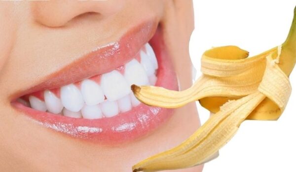 Sử dụng phần mặt trong của vỏ chuối và thao tác chà sát lên răng