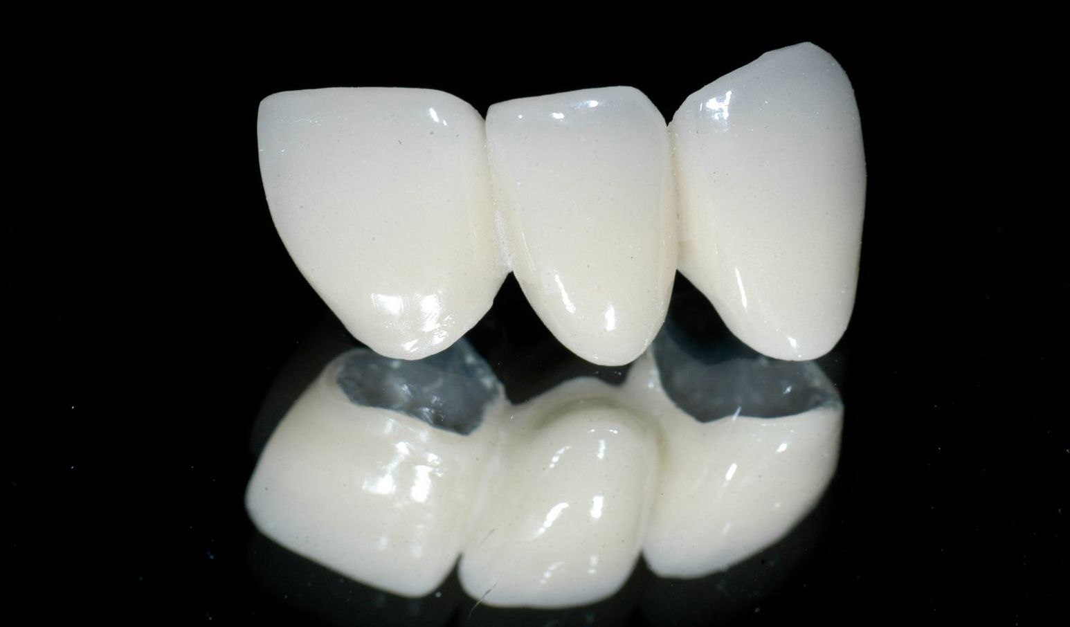 Đặc điểm các loại răng sứ Titan